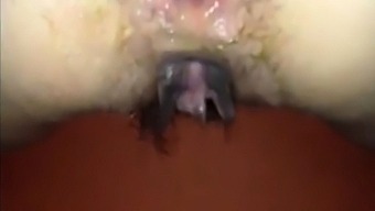 ejaculation anale